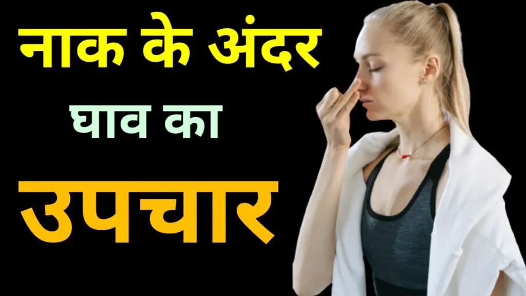 नाक के अंदर घाव का उपचार (Naak ke Andar Ghav ka Upchar)