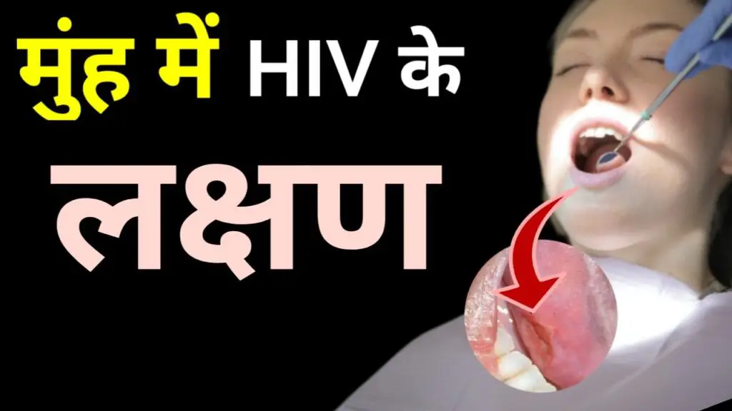 मुंह में एचआईवी लक्षण - अगर मुंह में दिखें ये लक्षण तो हो सकते हैं HIV के संकेत

