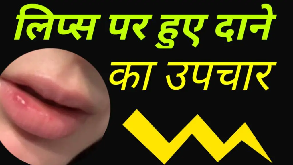 लिप्स पर छोटे-छोटे दाने का घरेलु उपचार