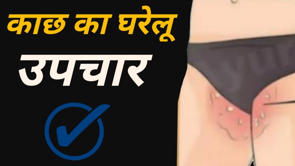 काछ लगने का घरेलू उपचार in hindi