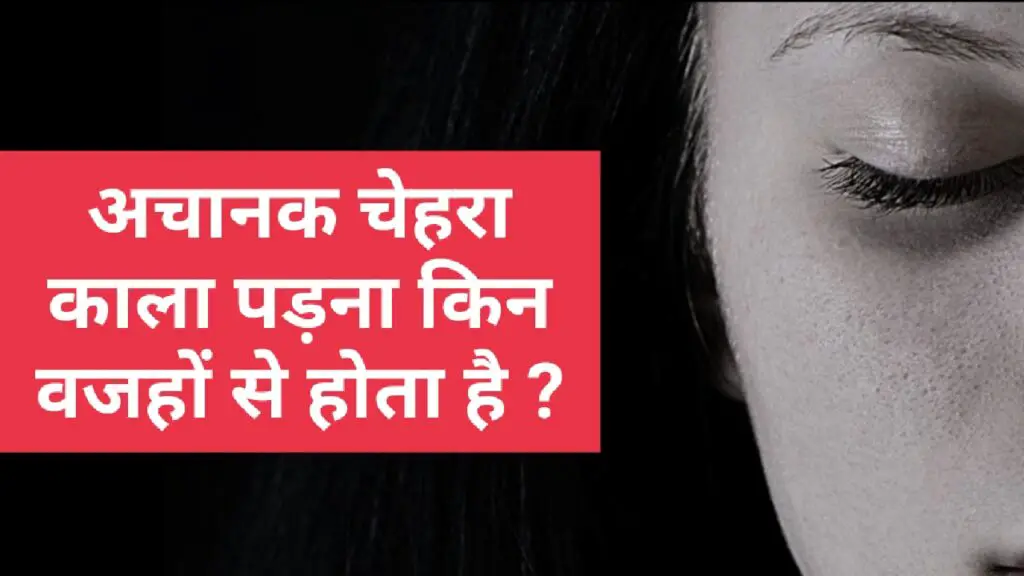 अचानक चेहरा काला पड़ना किन वजहों से होता है ?