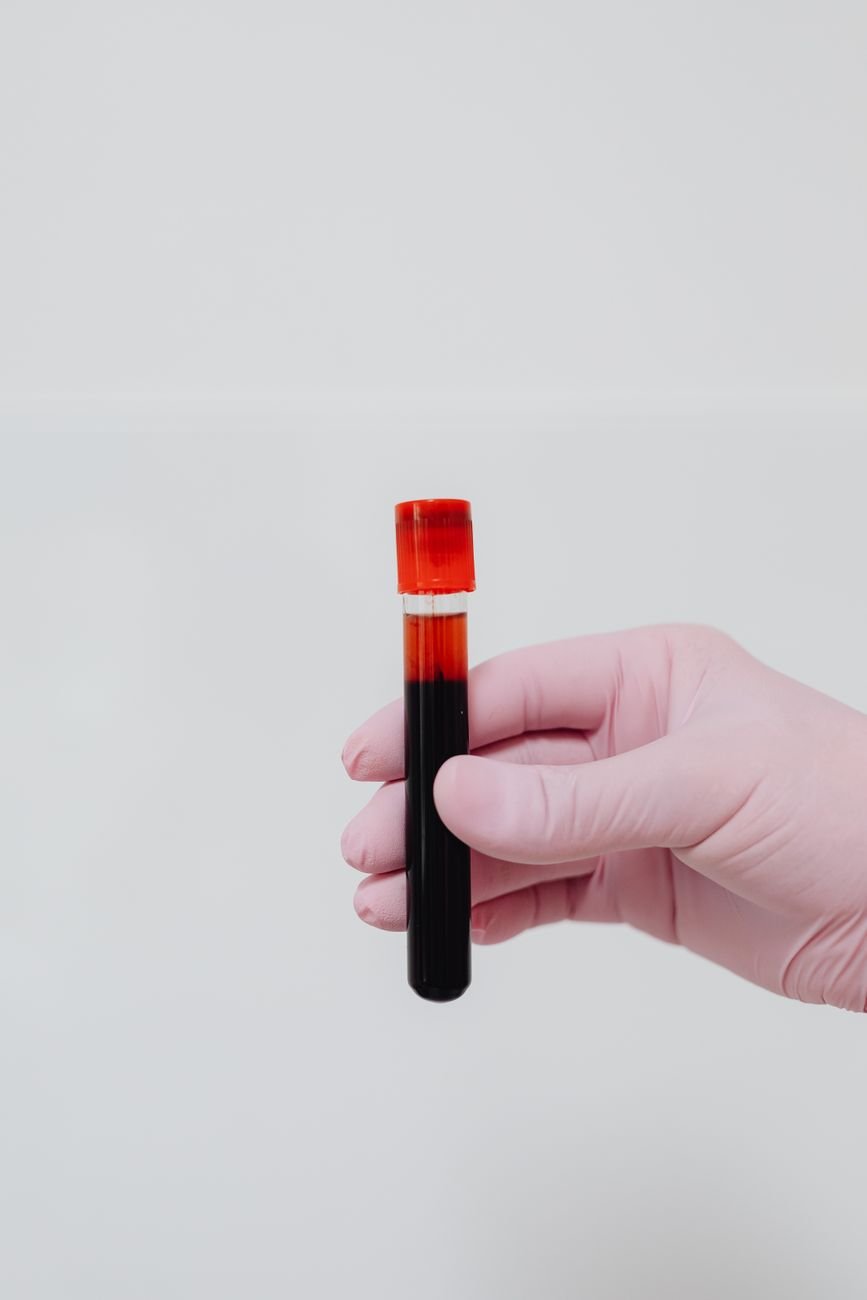 hand of a person in gloves holding a test tube