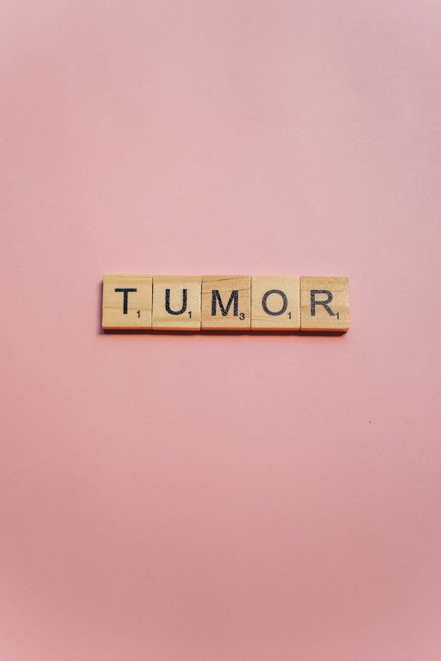 tumor spelled on wooden scrabble pieces