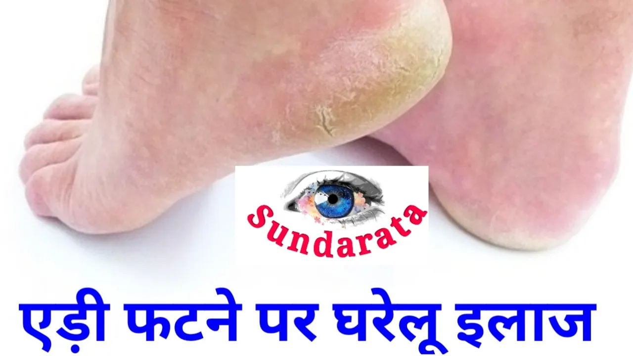 Thumbnail 1678335125372