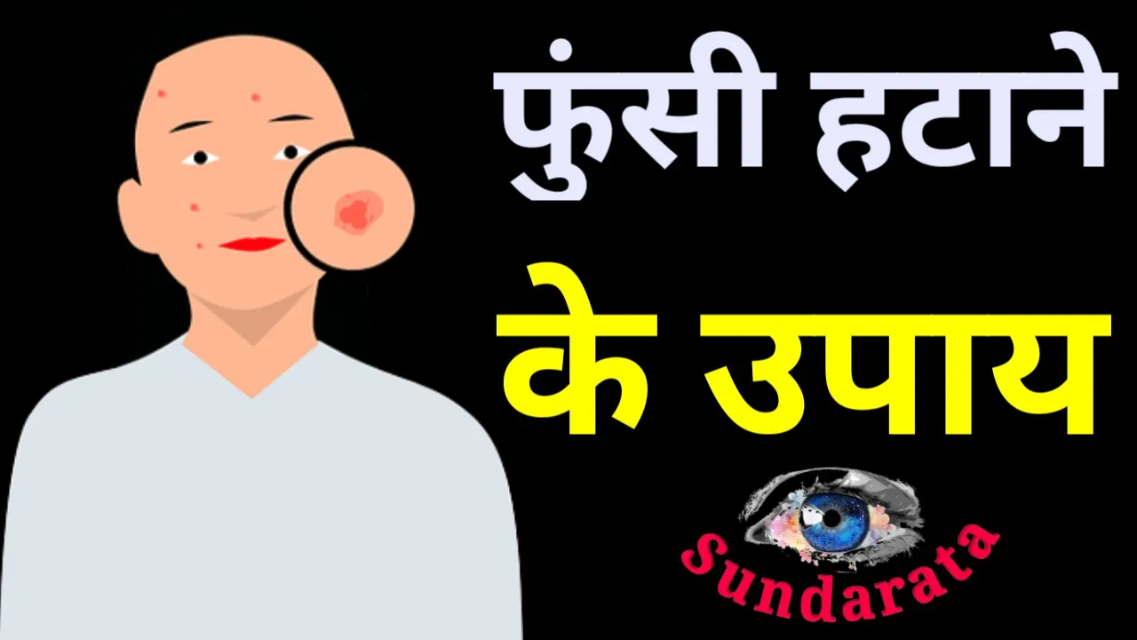 Thumbnail 1678699164001
