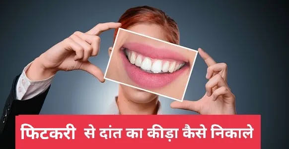 फिटकरी से दांत का कीड़ा कैसे निकाले