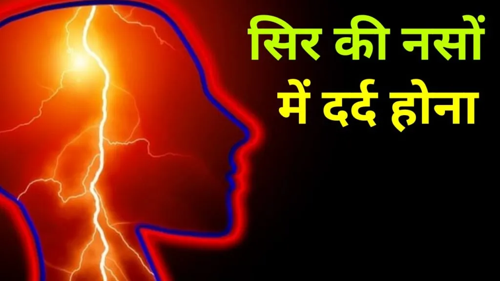 सिर की नसों में दर्द होना