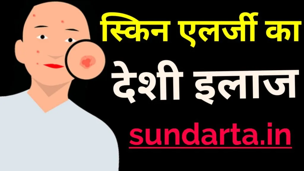 स्किन एलर्जी का देसी इलाज