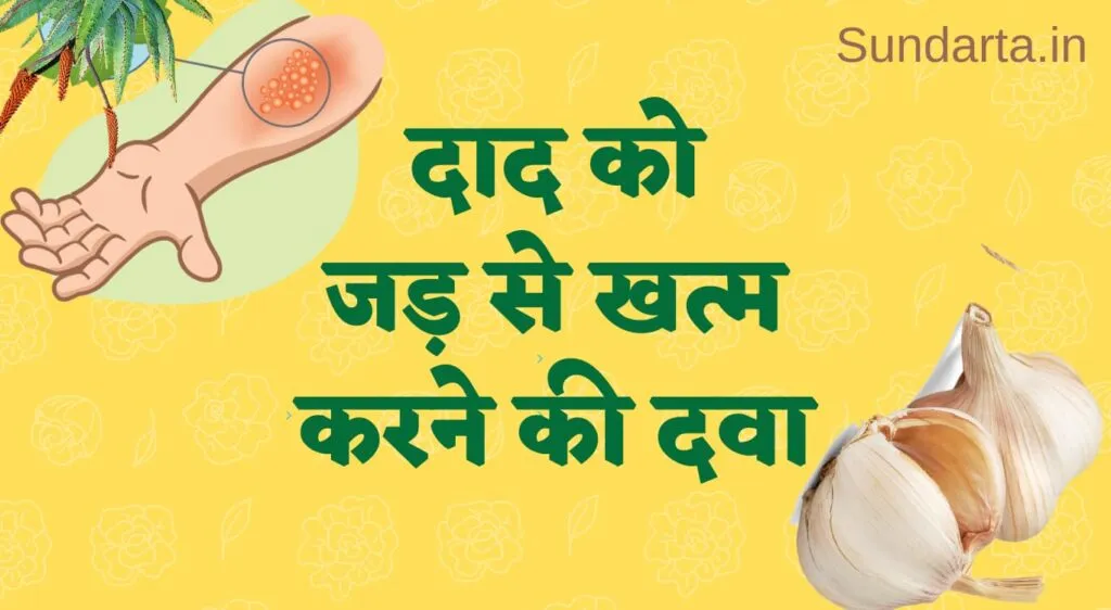 दाद को जड़ से खत्म करने की दवा - घरेलू उपाय क्रीम और अंग्रेजी टेबलेट